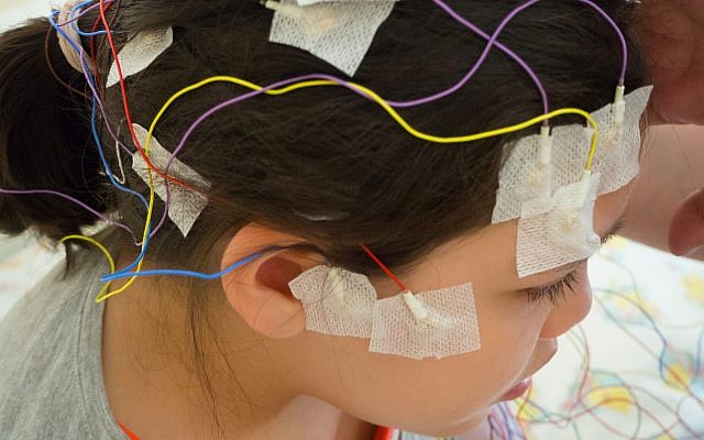 Illustrative - Girl with EEG electrodes attached to her head. (Luaeva, Getty Images)